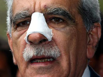 Kurdish MP hospitalized amid Novruz clashes Kurdish MP hospitalized amid Novruz clashes