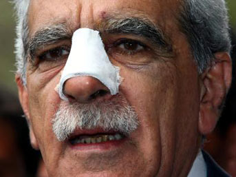 Kurdish MP hospitalized amid Novruz clashes