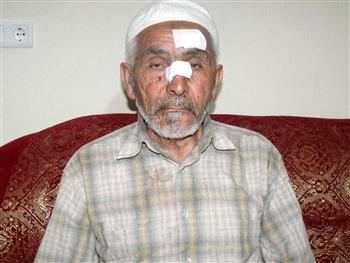 Victimized Arif Ekiz filed an official complaint against the rascal imam who attacked him 