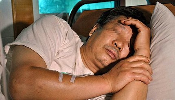 Chinese penis on the run : Love affair ends up brutally ! Fei Lin regrets the mistake of his life after his penis is gone Chinese penis on the run : Love affair ends up brutally ! Fei Lin regrets the mistake of his life after his penis is gone