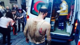 Turkey Istanbul Explosion:Heavy explosion center of Istanbul dozens people injured / Breaking News item-thumbnail