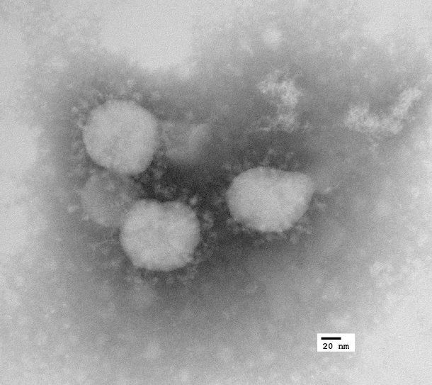 New Coronavirus New Coronavirus