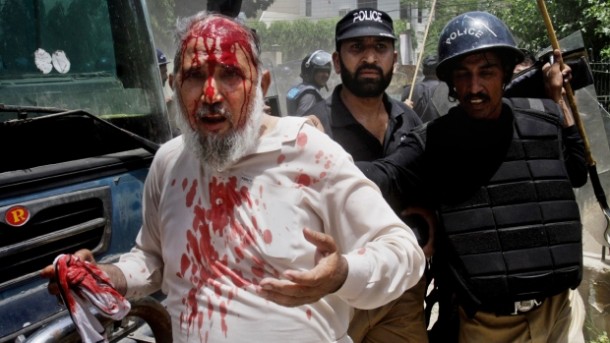 Anti-government protestor injured in police action. File pic