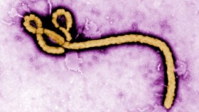 Pakistan devises strategy to prevent spread of Ebola item-thumbnail