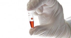 Race for Ebola Vaccine for West Africa: Another Ebola Vaccine Due to be tested in West Africa / Africa News item-thumbnail