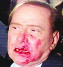 Berlusconi Saldırı