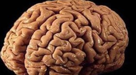 Bilim insanları minyatür insan beyni üretti