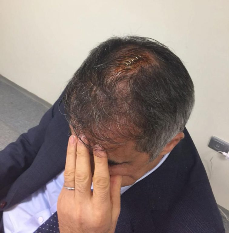 Şenol Güneş ambulans ile hastaneye götürüldü olaylı derbi tatil edildi 4 Şenol Güneş sedye ile hastaneye götürüldü olaylı derbi tatil edildi
