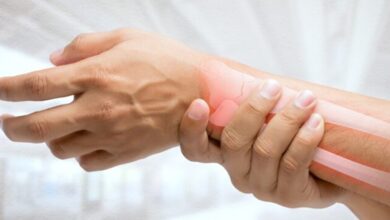 Hypertension bone aging