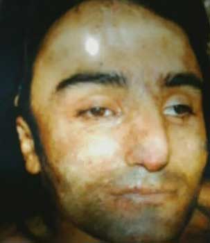 Son dakika! Canlı bombanın örgütü PKK çıktı, ismi Vedat Acar 1 canli bomba fotograf1
