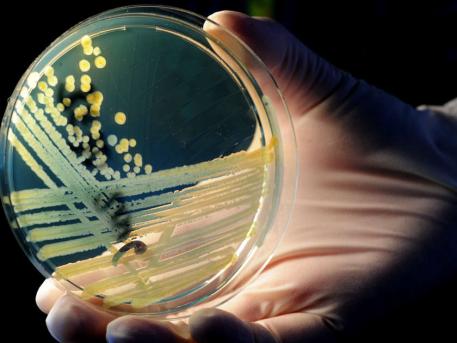 Avrupa’daki E. coli salgınının sorumlusu