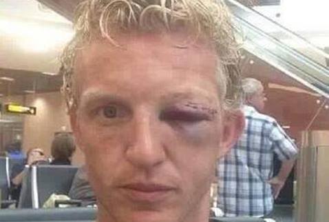 Fenerbahçeli Kuyt antrenmanda bu hale geldi 1 kuyt kafa goz