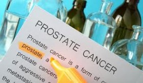 prostat kanseri tedavi