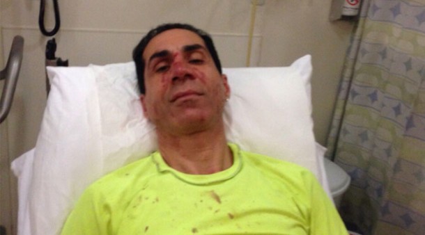 CHP'nin en aktif meclis üyelerinden Hüseyin Sağ saldırıya uğradı! 1 huseyin sag saldiri