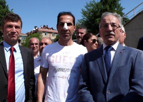 Hüseyin Sağ'a saldıran 2 kişi gözaltına alındı 1 huseyin sag saldiri2