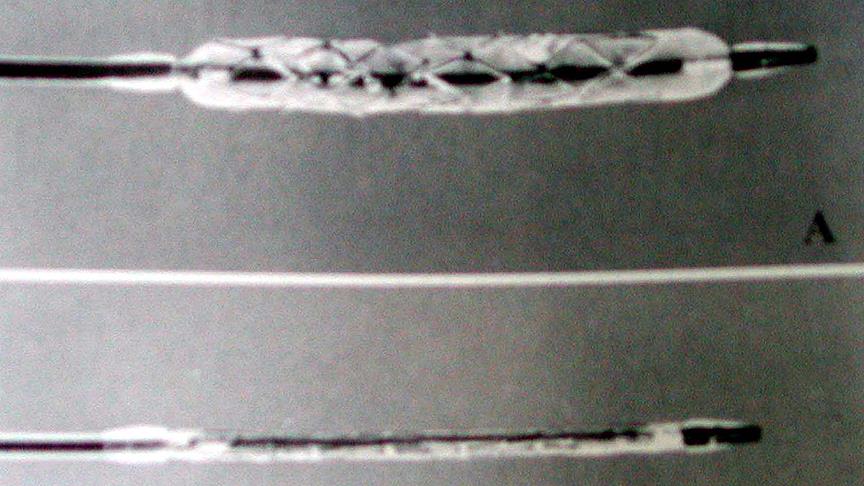 Kalp hastalıklarının tedavisinde müthiş buluş 1 sac teli stent