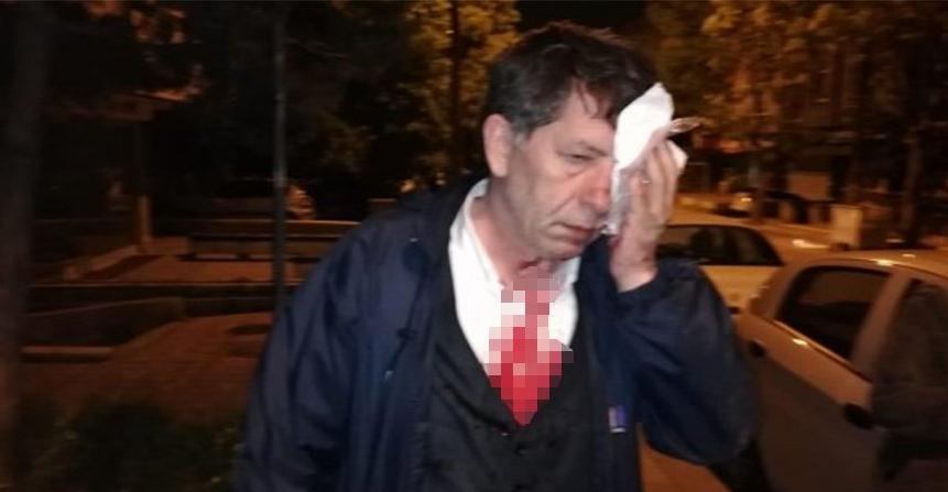 Saldırıya uğrayan Demirağ: Türk milliyetçileri size köpeklik etmeyecek! 1 yavuz selim demirag