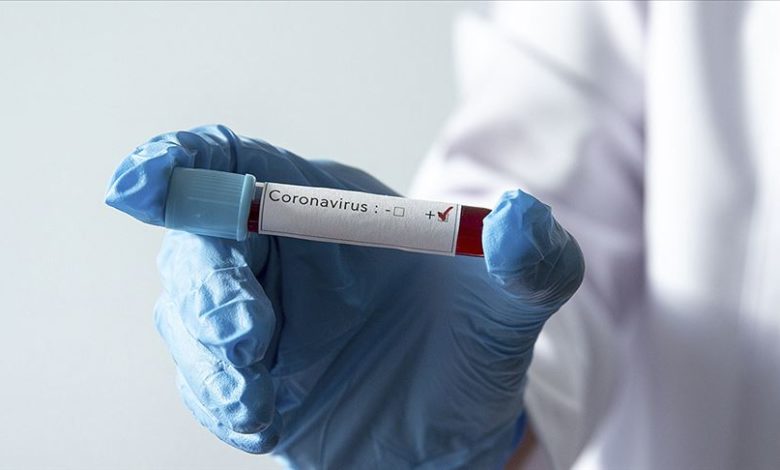 koronavirus pozitif 9148711