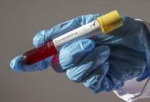 koronavirus test pozitif