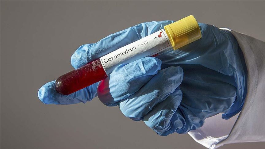 koronavirus test pozitif