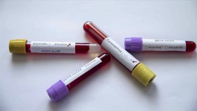 koronavirus testleri