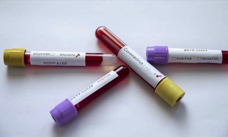 koronavirus testleri