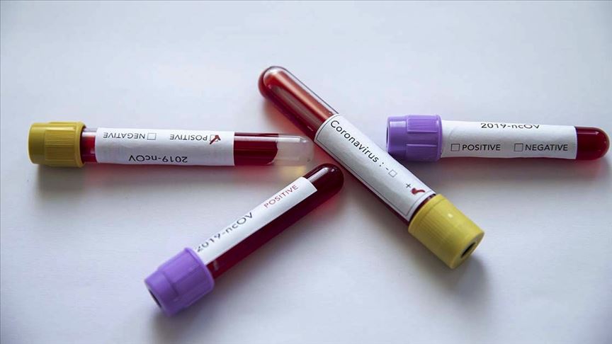 KKTC'de ilk ölüm 1 koronavirus testleri