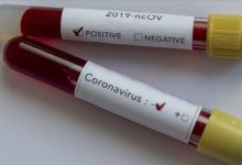 koronavirus testi negatif pozitif