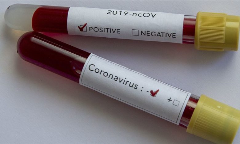 Plazma nakledildi, testi negatife döndü 2 koronavirus testi negatif pozitif