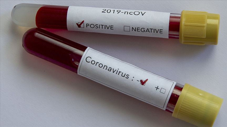 koronavirus testi negatif pozitif