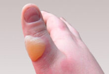 Video çekmek isterken üzerine kolonya döküp kendini ateşe veren 11 yaşındaki bir çocuğun hayatını kaybetmesi herkesi üzdü.