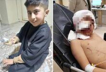 Erzurum’un Narman ilçesinde bakkala gitmek için evden çıkan 10 yaşındaki Murat Tutar, sokak köpeklerinin saldırısına uğrayarak ağır yaralandı.