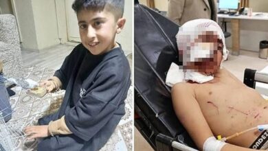 Sokak köpeklerinin saldırdığı 10 yaşındaki Murat yoğun bakımda 8 Erzurum’un Narman ilçesinde bakkala gitmek için evden çıkan 10 yaşındaki Murat Tutar, sokak köpeklerinin saldırısına uğrayarak ağır yaralandı.