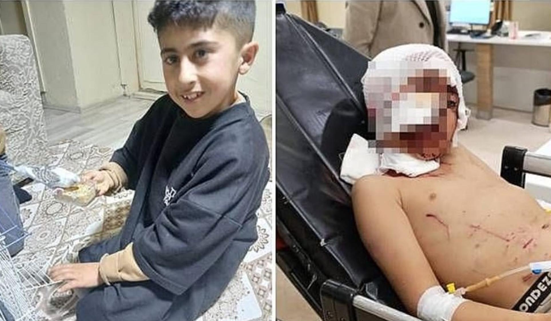 Sokak köpeklerinin saldırdığı 10 yaşındaki Murat yoğun bakımda 1 Erzurum’un Narman ilçesinde bakkala gitmek için evden çıkan 10 yaşındaki Murat Tutar, sokak köpeklerinin saldırısına uğrayarak ağır yaralandı.
