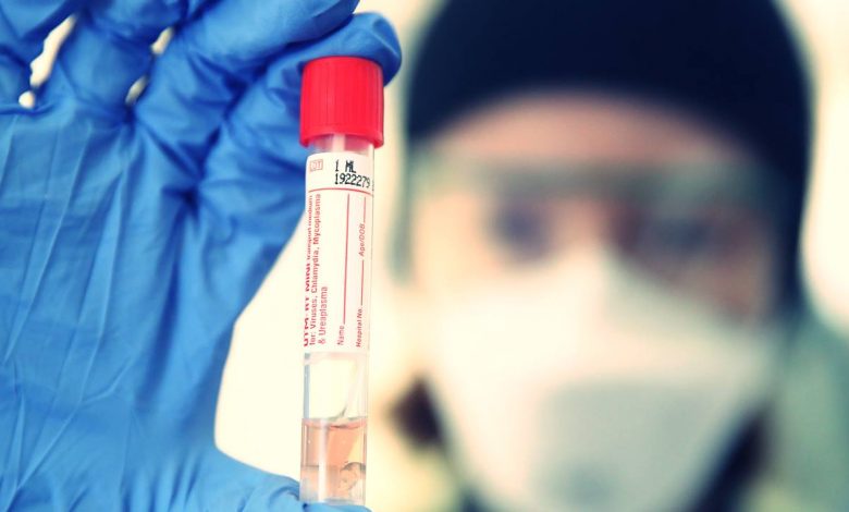 Koronavirüs Tükürük Testi Hazır