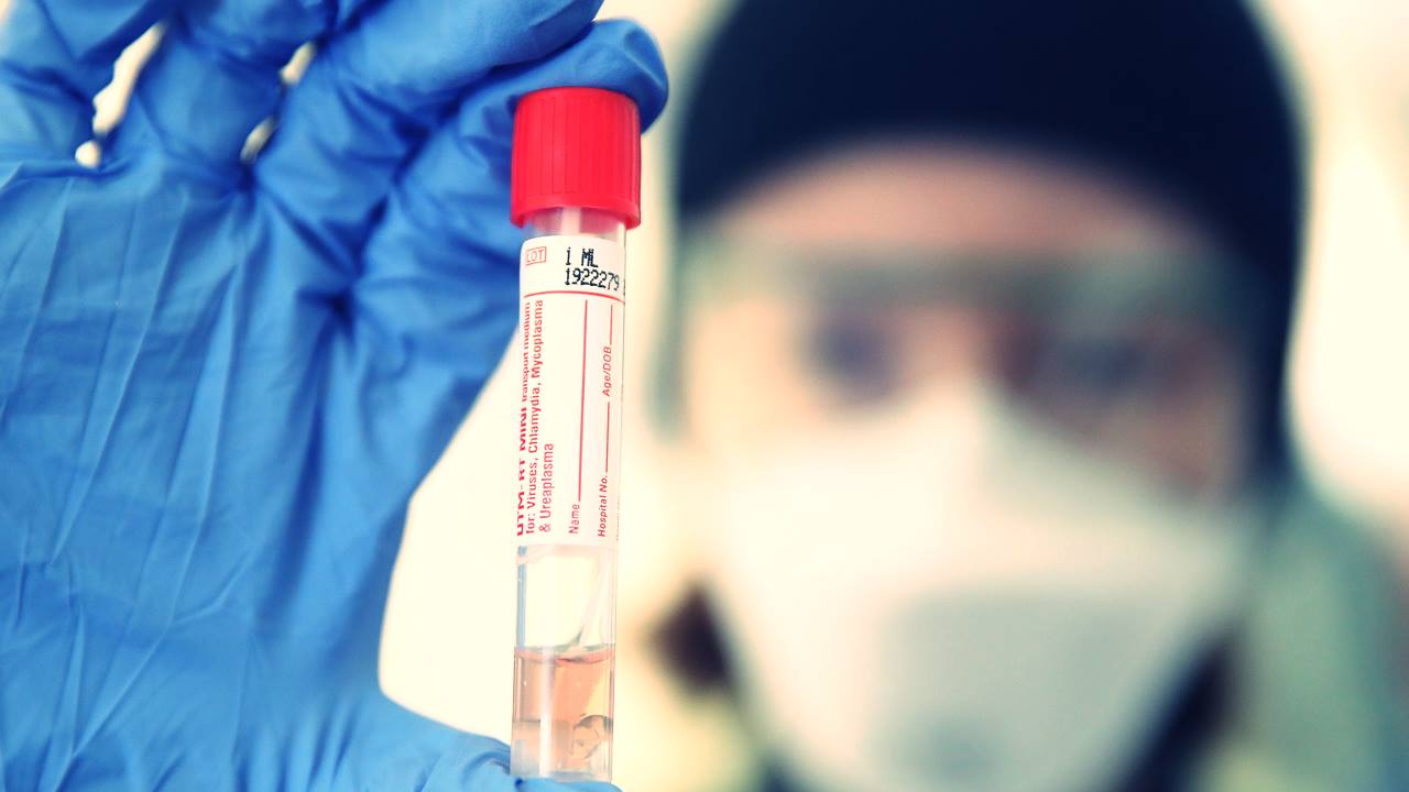 30 Dakikada Sonuç Veren Koronavirüs Tükürük Testi 1 Koronavirüs Tükürük Testi Hazır