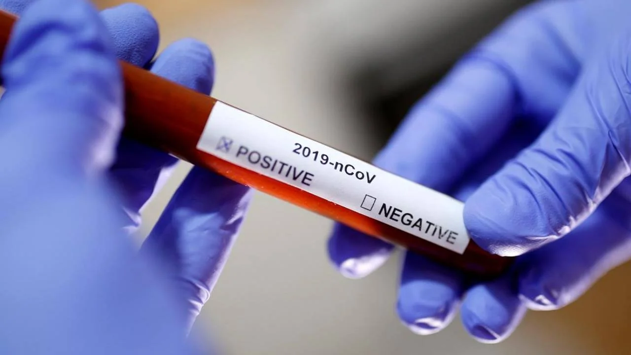 Koronavirüs Testlerinin Doğruluk Oranı Yüzde 40 mı? 1 koronavirus testi