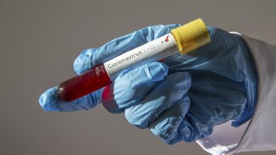 Ayrıcalıklı Kişilere Günde 30 Bin Test İddiası! 8 koronavirus testi