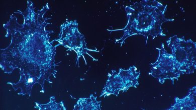Araştırma: Kanser hücreleri uyku haline geçerek kemoterapiden kaçabilir