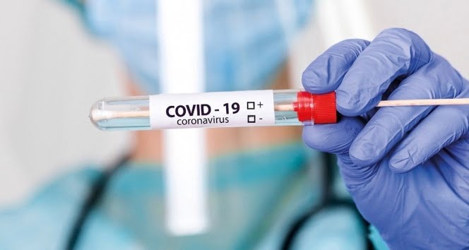DSÖ, Covid-19'un insanlardan hayvanlara bulaşma ihtimalini doğruladı 1 DSO Covid 19un insanlardan hayvanlara bulasma ihtimalini dogruladi