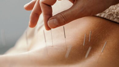 Çin'de yapılan bir bilimsel çalışma akupunkturun inme sonrası konuşma güçlüğü çekenlerin tedavisine katkıda bulunduğunu ortaya koydu.