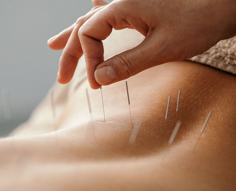 Çin'de yapılan bir bilimsel çalışma akupunkturun inme sonrası konuşma güçlüğü çekenlerin tedavisine katkıda bulunduğunu ortaya koydu.
