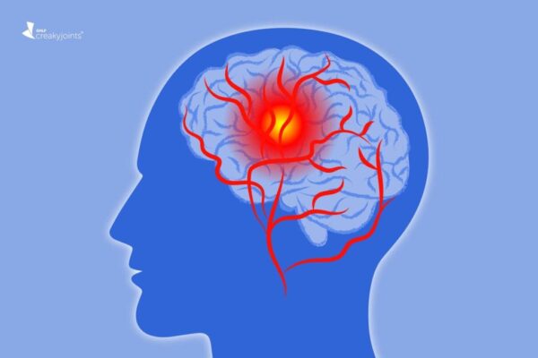 Sitikolin Nedir Sitikolin hakkında tüm bilgilr NationalTurk Sitikolin sayfalarında