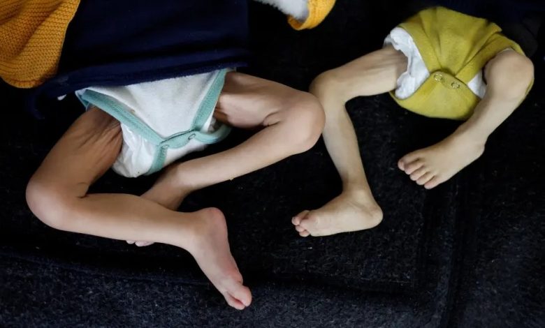 İsrail ablukası altındaki Gazze Şeridi’nde kıtlık derinleşirken, son 24 saatte 2’si çocuk 5 Filistinli açlıktan hayatını kaybetti.