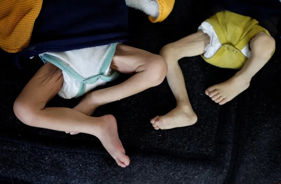 İsrail ablukası altındaki Gazze Şeridi’nde kıtlık derinleşirken, son 24 saatte 2’si çocuk 5 Filistinli açlıktan hayatını kaybetti.