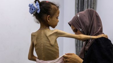 Gazze’de kıtlık resmen ilan edildi. Hastanelerde açlıktan kemikleri sayılan çocuklar doktorların çaresiz mücadelesiyle hayatta kalmaya çalışıyor.