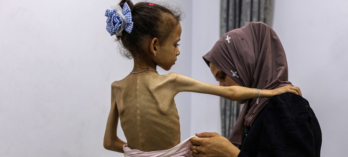 Gazze'deki hastanelerde açlıktan erimiş çocuklar tedavi ediliyor 1 Gazze’de kıtlık resmen ilan edildi. Hastanelerde açlıktan kemikleri sayılan çocuklar doktorların çaresiz mücadelesiyle hayatta kalmaya çalışıyor.