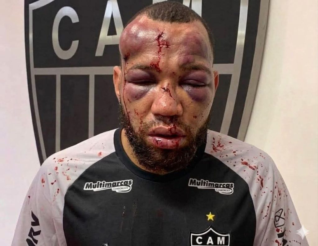 Brezilya’da tarihi maç! Tam 23 kırmızı kart 1 everson