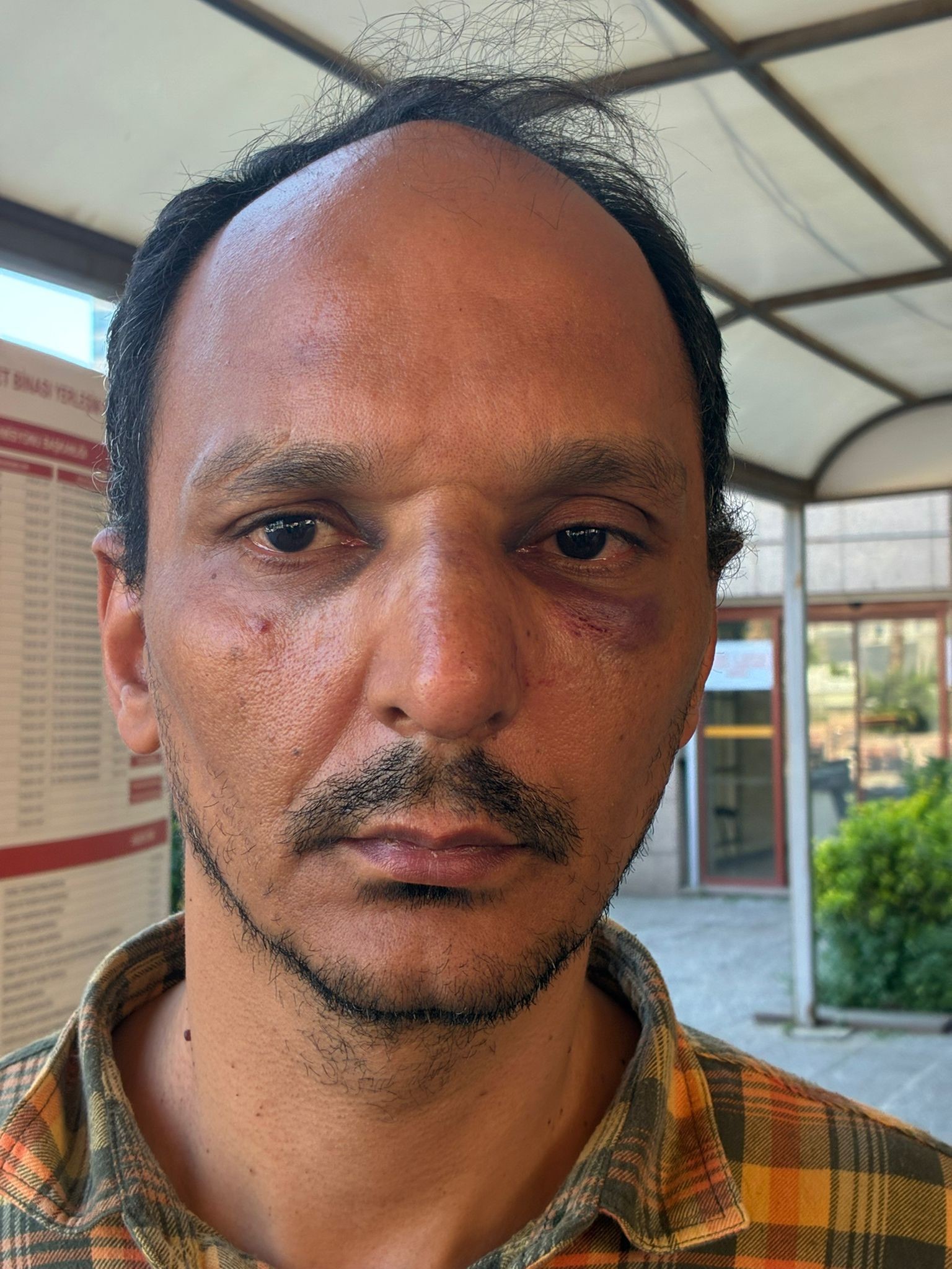 TOMA'ya çıkan kişi tutuklandı 1 toma2