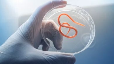 ABD’de gıda kaynaklı salgın alarmı: 7 bine yakın kişi risk altında 1 ABD’de şiddetli ishal, bulantı ve halsizliğe yol açan siklosporiyazis salgını nedeniyle sağlık alarmı verildi.
